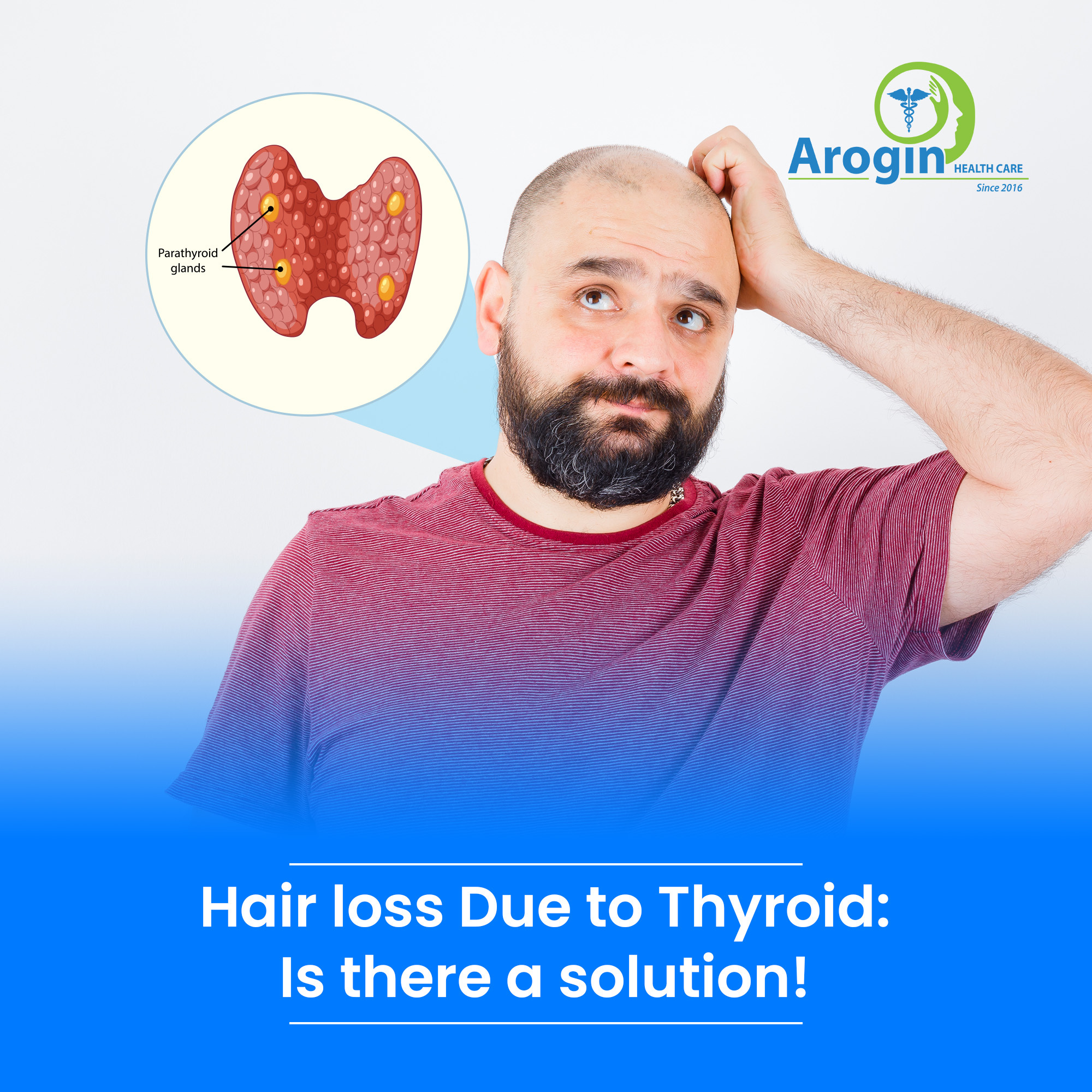 Thyroid and Hair Loss: The Complete Guide to Causes, Symptoms, and Treatment in Nepal
